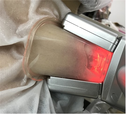 Selülit Azaltma İçin Çift Kanallı Tip Cryolipolysis Yağ Dondurma Makinesi