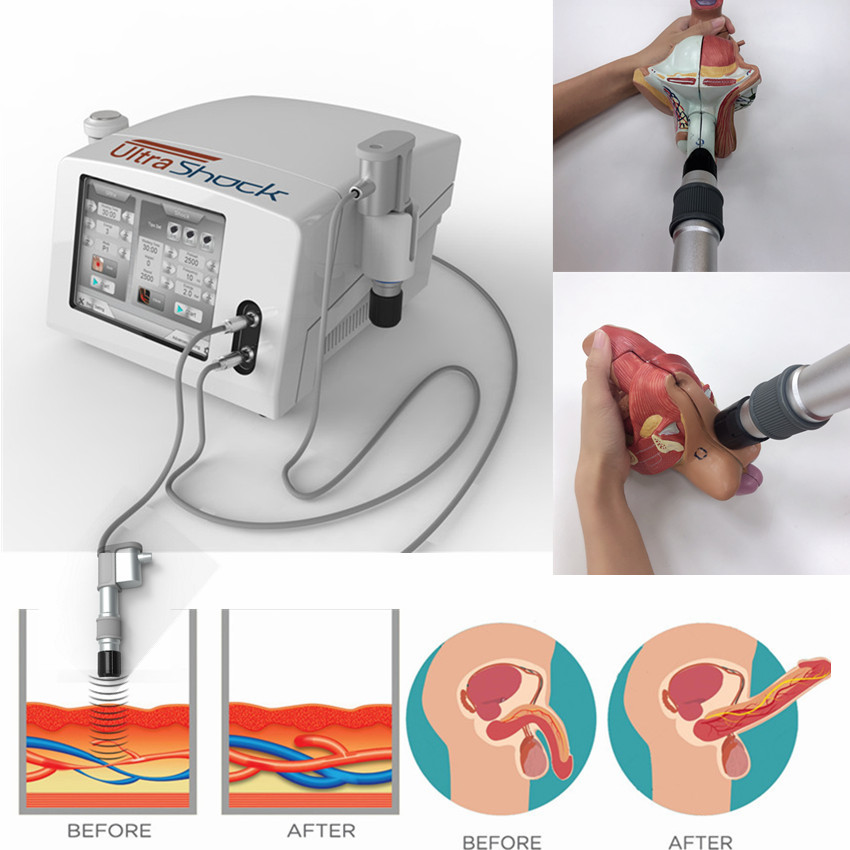 Vücut Ağrısının Giderilmesi İçin Shockwave Ultrason Fizyoterapi Makinesi
